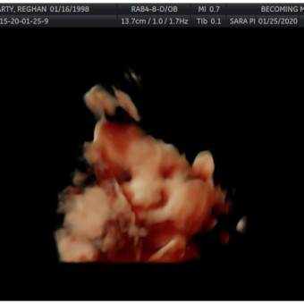 Babylist Registry Photo.