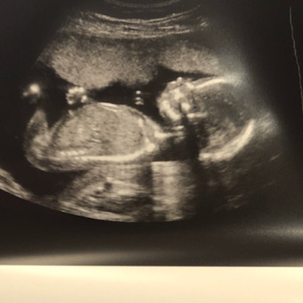 Babylist Registry Photo.