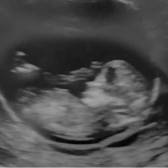 Babylist Registry Photo.