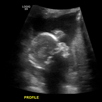 Babylist Registry Photo.