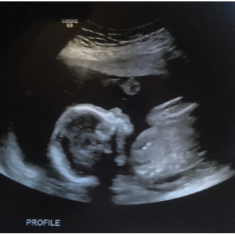 Babylist Registry Photo.