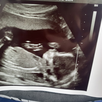 Babylist Registry Photo.