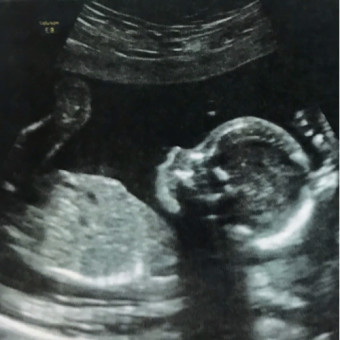 Babylist Registry Photo.