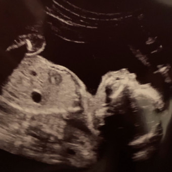Babylist Registry Photo.