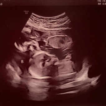 Babylist Registry Photo.