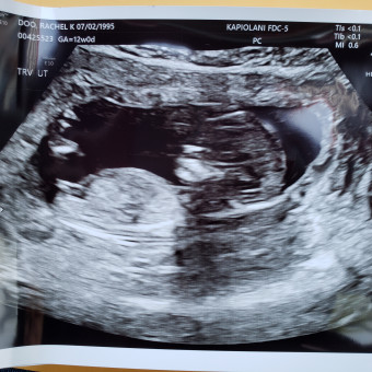 Babylist Registry Photo.