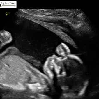 Babylist Registry Photo.
