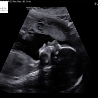 Babylist Registry Photo.