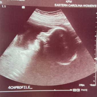 Babylist Registry Photo.
