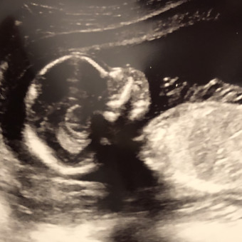 Babylist Registry Photo.