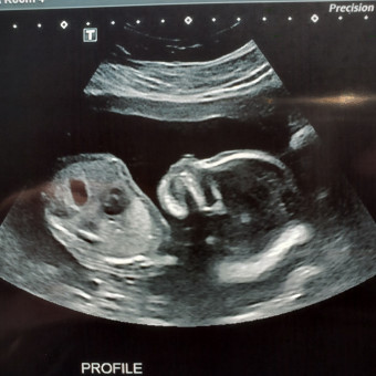Babylist Registry Photo.