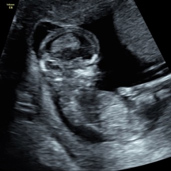 Babylist Registry Photo.