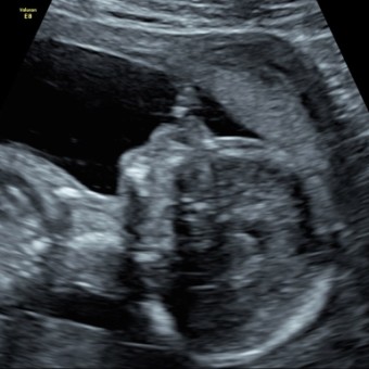 Babylist Registry Photo.