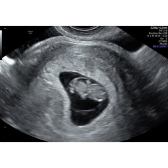 Babylist Registry Photo.
