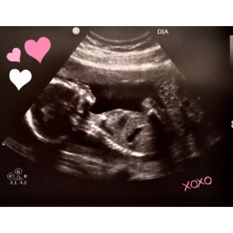 Babylist Registry Photo.