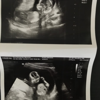 Babylist Registry Photo.