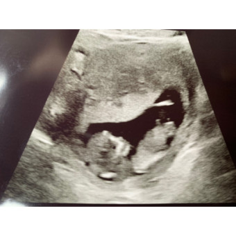Babylist Registry Photo.