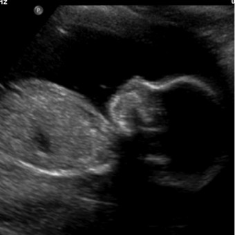 Babylist Registry Photo.