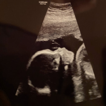 Babylist Registry Photo.
