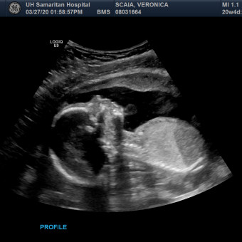 Babylist Registry Photo.
