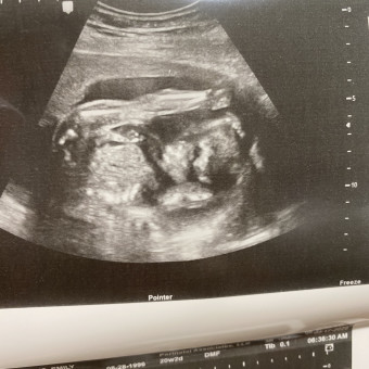 Babylist Registry Photo.