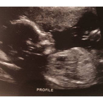 Babylist Registry Photo.