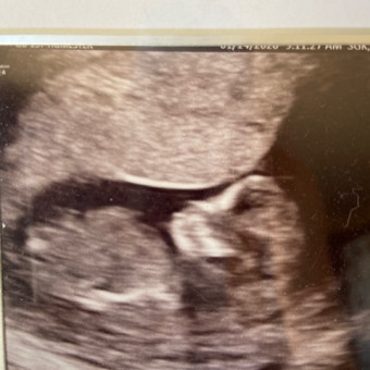 Babylist Registry Photo.