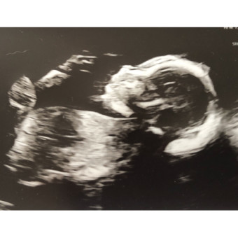 Babylist Registry Photo.