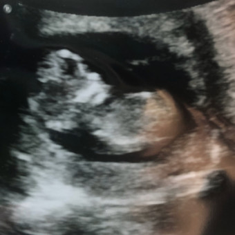 Babylist Registry Photo.