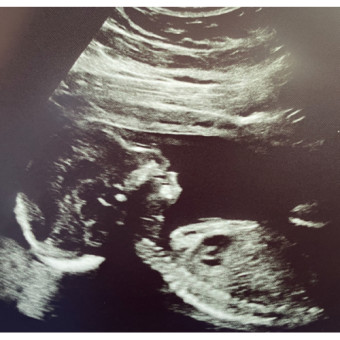 Babylist Registry Photo.