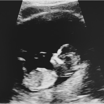 Babylist Registry Photo.