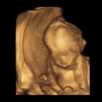 Babylist Registry Photo.