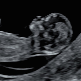 Babylist Registry Photo.
