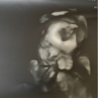 Babylist Registry Photo.