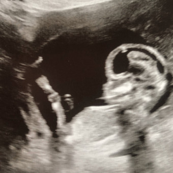 all over bib for high chair