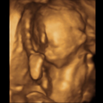 Babylist Registry Photo.