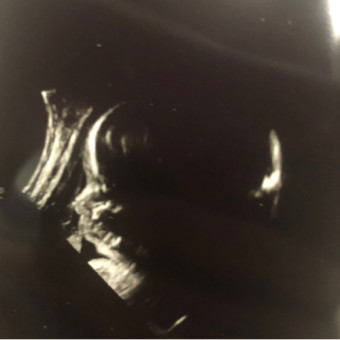 Babylist Registry Photo.
