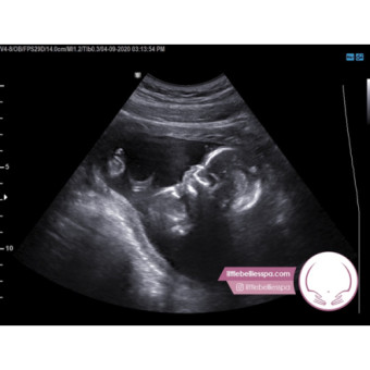 Babylist Registry Photo.