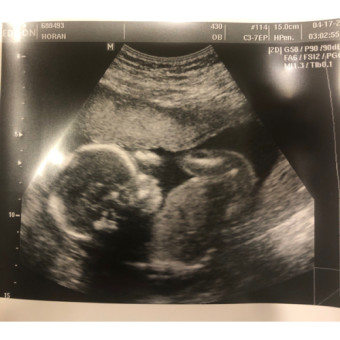 Babylist Registry Photo.