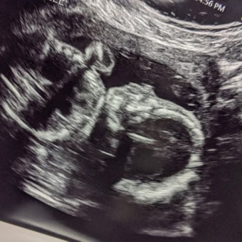 Babylist Registry Photo.