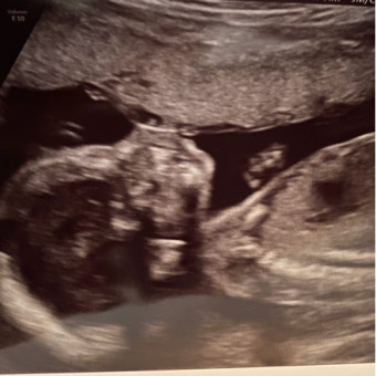 Babylist Registry Photo.