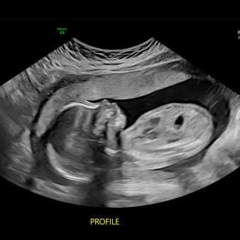 Babylist Registry Photo.