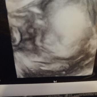 Babylist Registry Photo.