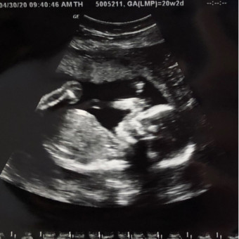 Babylist Registry Photo.
