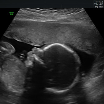 Babylist Registry Photo.