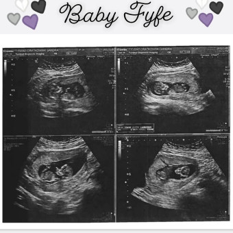 Babylist Registry Photo.