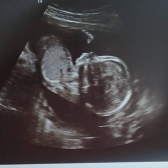 Babylist Registry Photo.