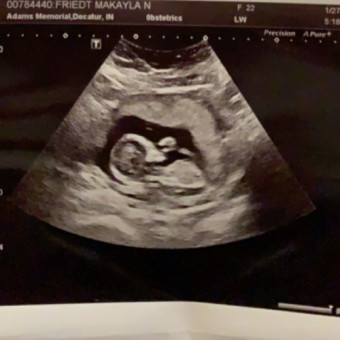 Babylist Registry Photo.