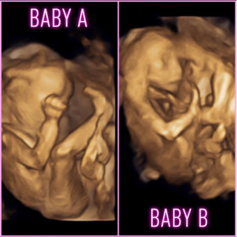 Babylist Registry Photo.
