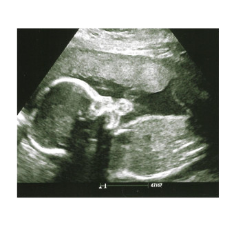 Babylist Registry Photo.